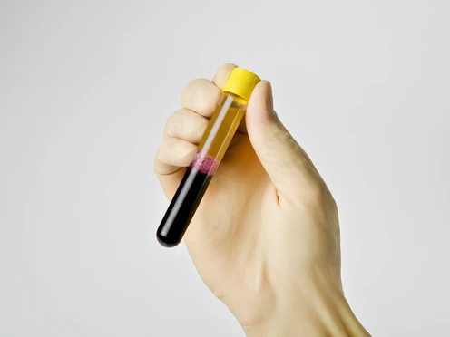 PRP Facelift: A Guide Through the Pros and Cons