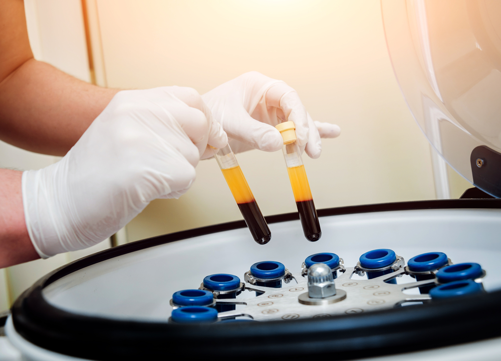 Ovarian PRP: A Glimpse into the Future of Infertility Care