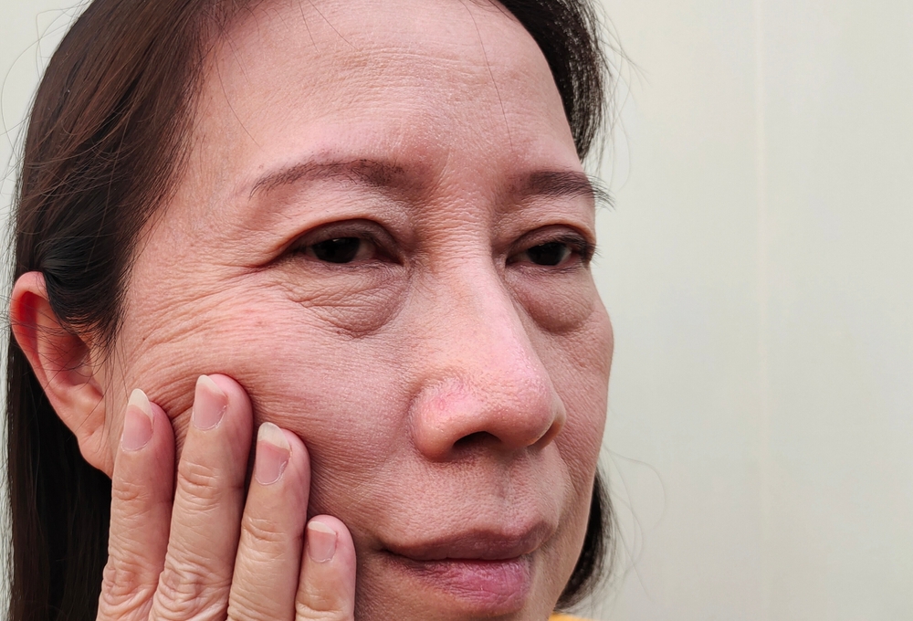 Learn All About PRP Under-Eyes Treatment