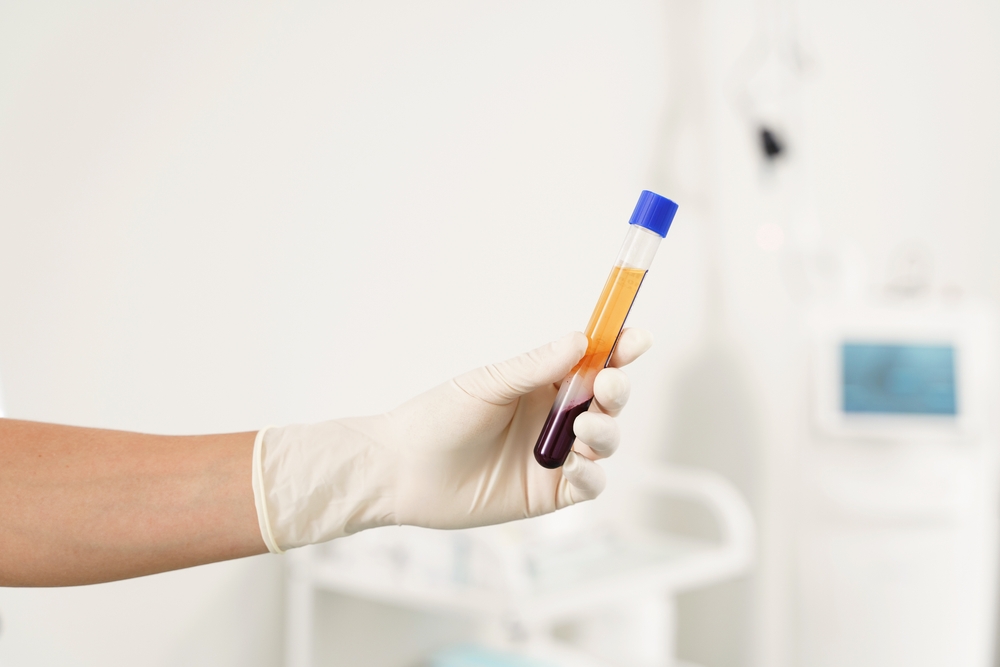 PRF vs PRP vs PRFM: What's the Difference and Which One Is the Best?