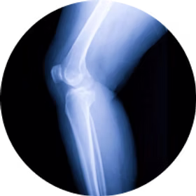 Orthopedics
