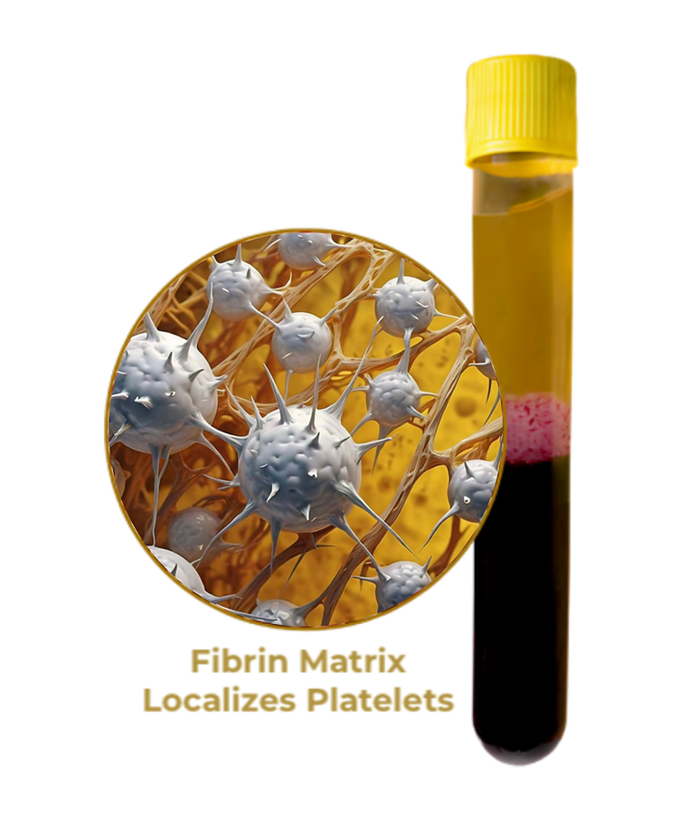 Fibrin Matrix Localizes Platelets
